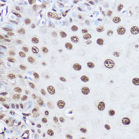SART1 Rabbit polyclonal antibody
