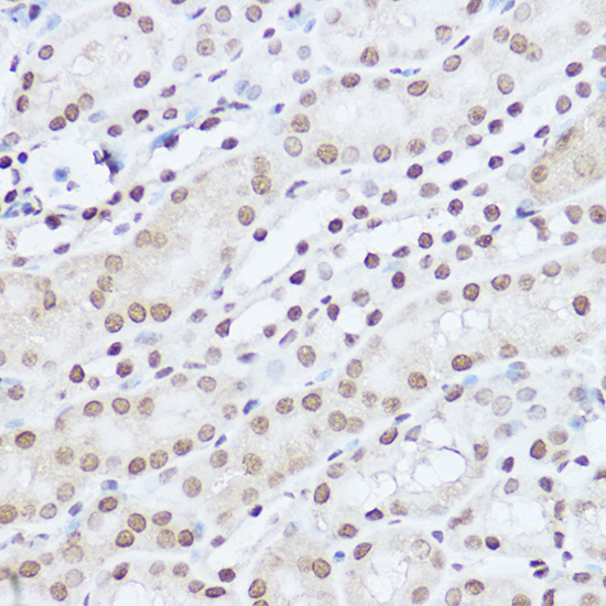 SART1 Rabbit polyclonal antibody