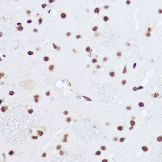 SART1 Rabbit polyclonal antibody