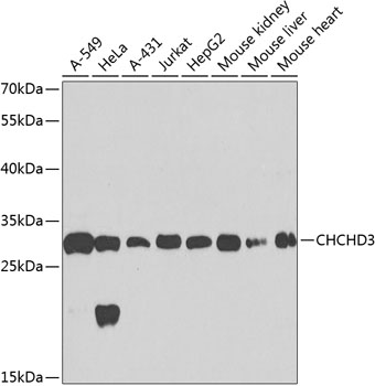 CHCHD3 Rabbit polyclonal antibody