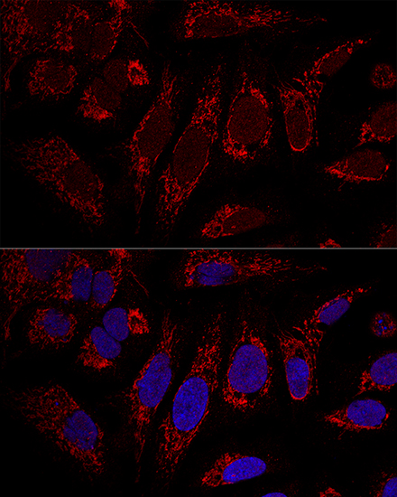 CHCHD3 Rabbit polyclonal antibody