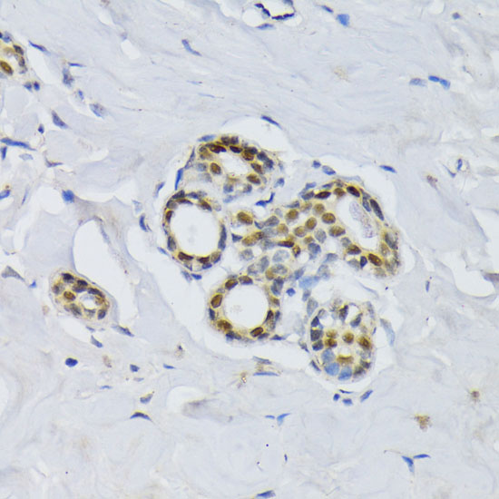 BCCIP Rabbit polyclonal antibody
