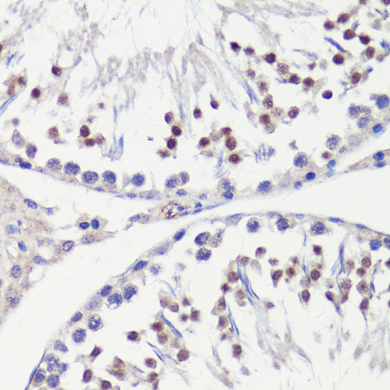 HFM1 Rabbit polyclonal antibody