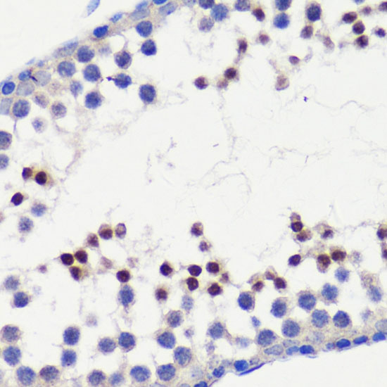 HFM1 Rabbit polyclonal antibody