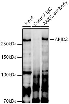 ARID2 Rabbit polyclonal antibody