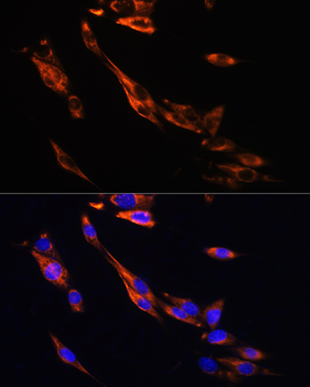 ADRB3 Rabbit polyclonal antibody