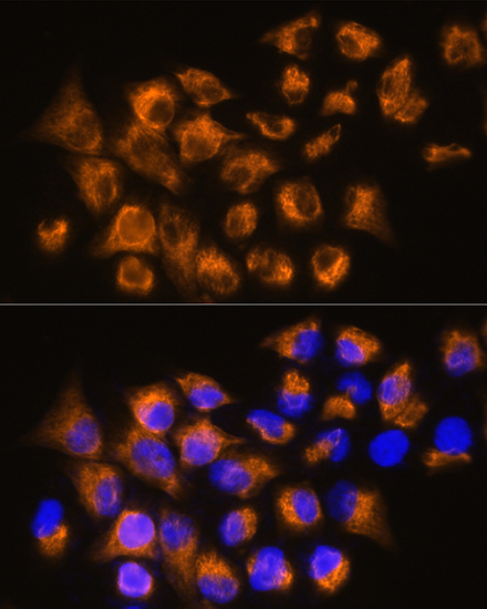 ADRB3 Rabbit polyclonal antibody
