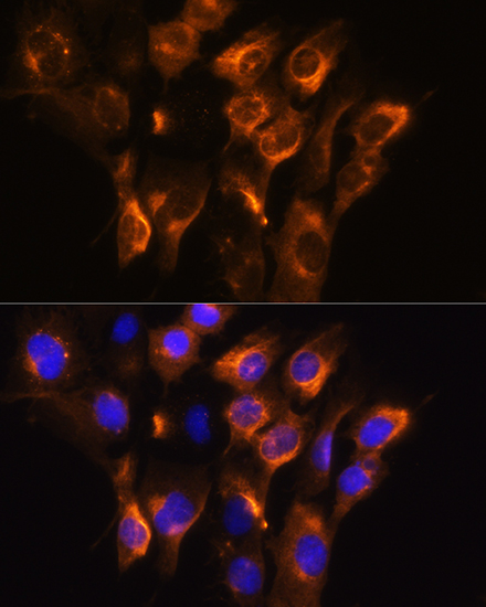 ADRB3 Rabbit polyclonal antibody