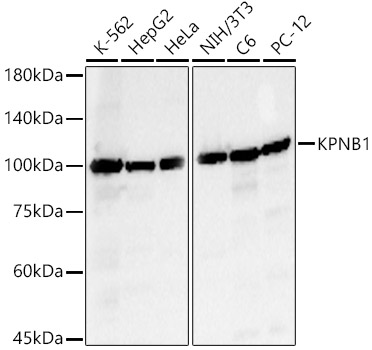 KPNB1 Rabbit polyclonal antibody