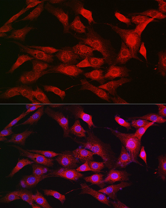 KPNB1 Rabbit polyclonal antibody
