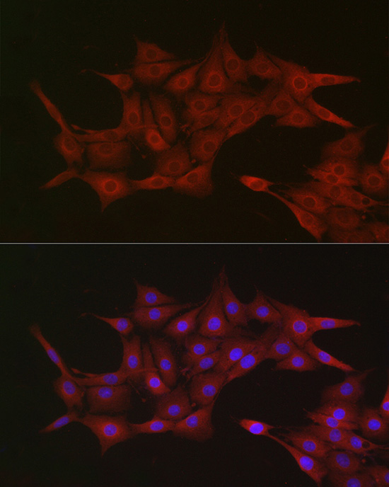 KPNB1 Rabbit polyclonal antibody
