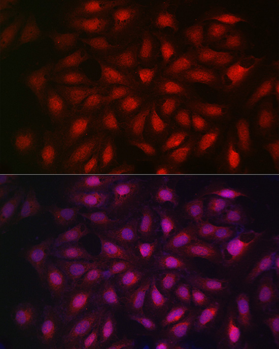 KPNB1 Rabbit polyclonal antibody