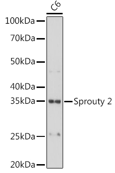 Sprouty 2 Rabbit monoclonal antibody