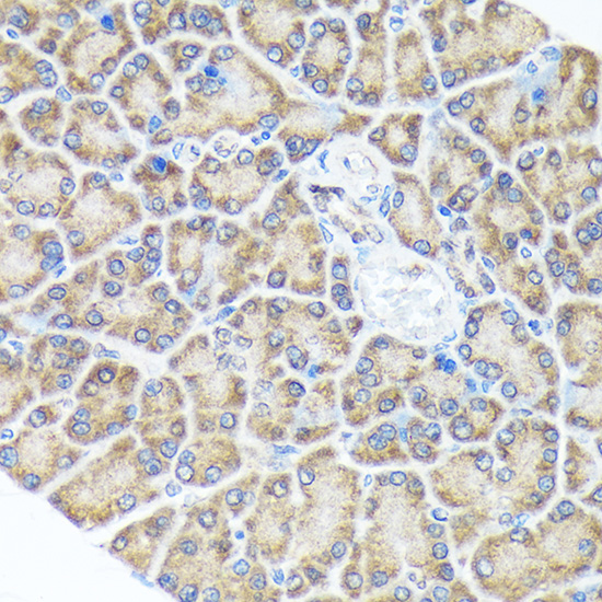 Sprouty 2 Rabbit monoclonal antibody
