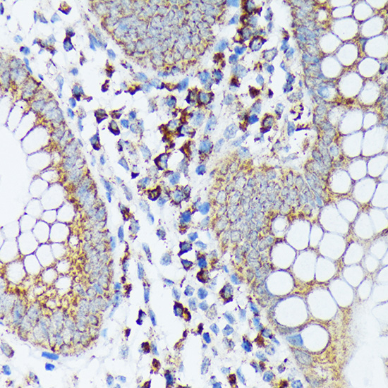 Sprouty 2 Rabbit monoclonal antibody
