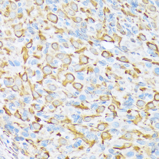 Sec23A Rabbit monoclonal antibody