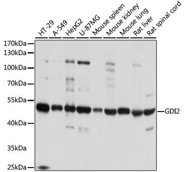 [KO Validated] GDI2 Rabbit polyclonal antibody