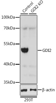 [KO Validated] GDI2 Rabbit polyclonal antibody