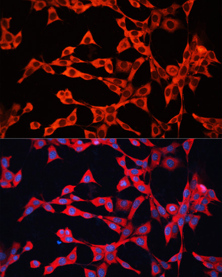 [KO Validated] GDI2 Rabbit polyclonal antibody