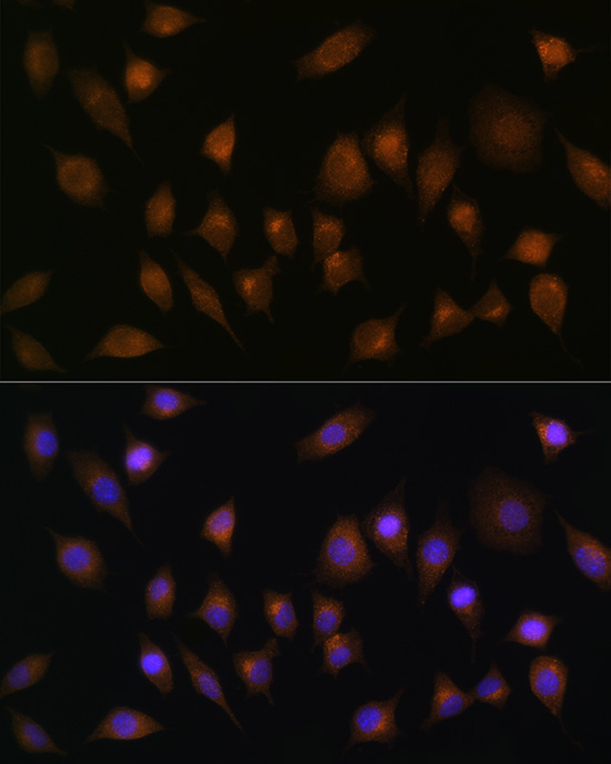 SNX1 Rabbit polyclonal antibody
