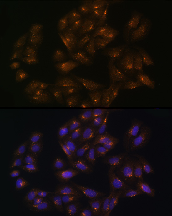 SNX1 Rabbit polyclonal antibody