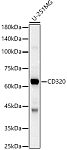 Western blot - CD320 Rabbit pAb (A8627)