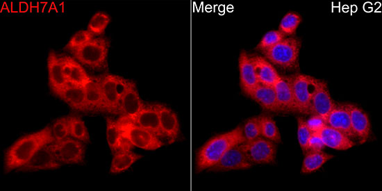 ALDH7A1 Rabbit polyclonal antibody