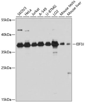 EIF3J Rabbit polyclonal antibody