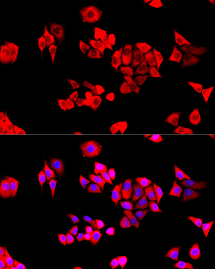 EIF3J Rabbit polyclonal antibody