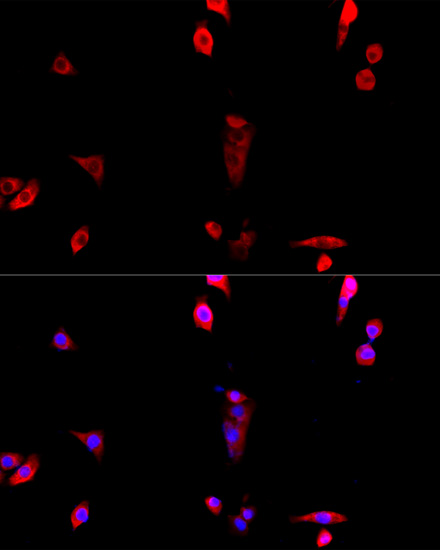 EIF3J Rabbit polyclonal antibody