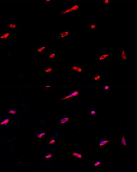 EIF3J Rabbit polyclonal antibody