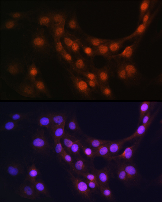 GMFB Rabbit polyclonal antibody