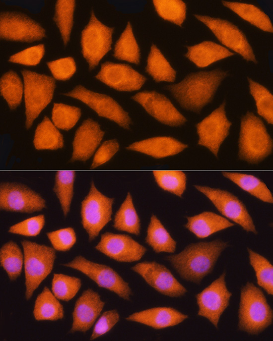 GMFB Rabbit polyclonal antibody