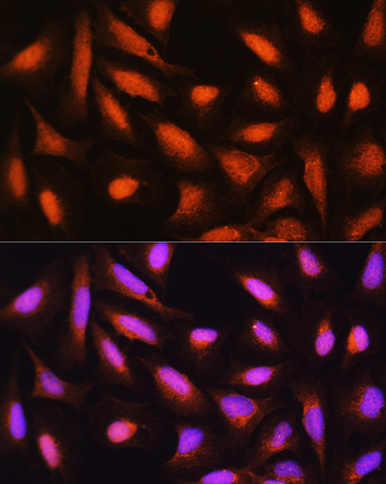 GMFB Rabbit polyclonal antibody