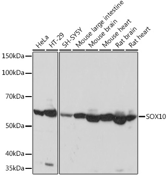 SOX10 Rabbit monoclonal antibody