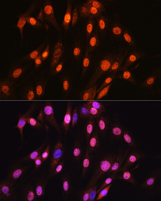 SOX10 Rabbit monoclonal antibody