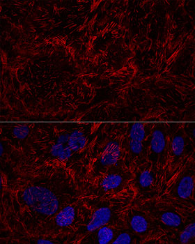 Septin 9 Rabbit polyclonal antibody