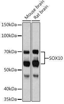 SOX10 Rabbit monoclonal antibody