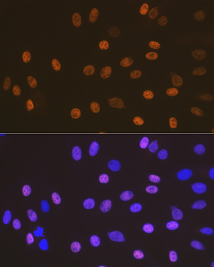 SOX10 Rabbit monoclonal antibody