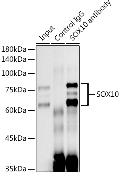 SOX10 Rabbit monoclonal antibody