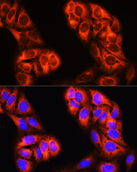 MTHFD1 Rabbit polyclonal antibody