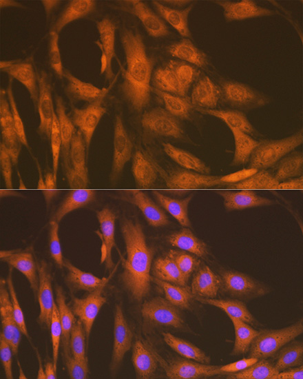 UAP1 Rabbit monoclonal antibody