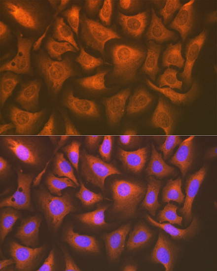 UAP1 Rabbit monoclonal antibody