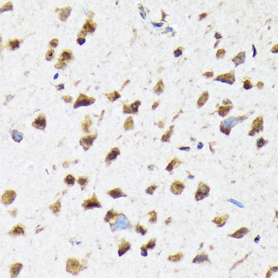 eIF2B epsilon (EIF2B5) Rabbit monoclonal antibody