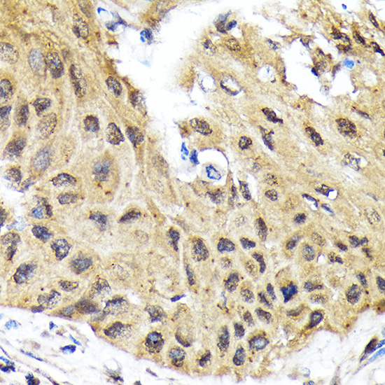 eIF2B epsilon (EIF2B5) Rabbit monoclonal antibody