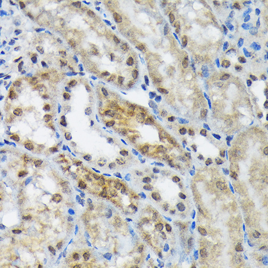 eIF2B epsilon (EIF2B5) Rabbit monoclonal antibody