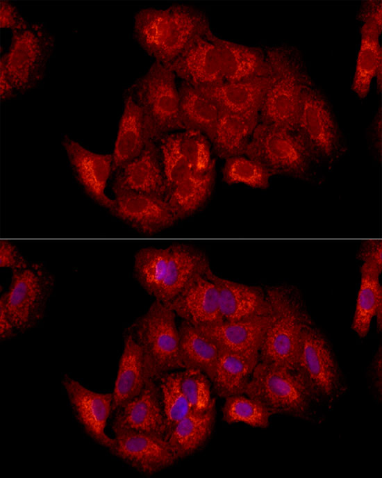 TIMM23 Rabbit polyclonal antibody