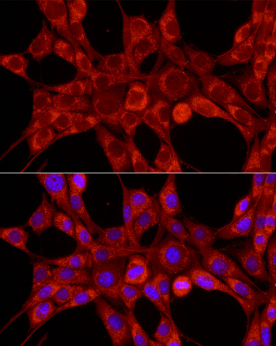 TIMM23 Rabbit polyclonal antibody