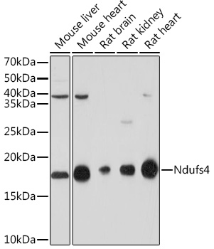 NDUFS4 Rabbit monoclonal antibody