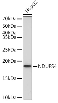 NDUFS4 Rabbit monoclonal antibody